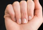 Manchas brancas nas unhas