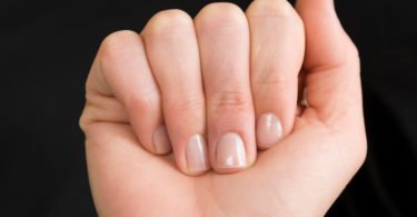 Manchas brancas nas unhas